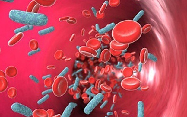 华氏巨球蛋白血症治疗选择指南： 类固醇皮质激素和免疫调节剂